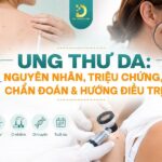 Tìm hiểu về ung thư da