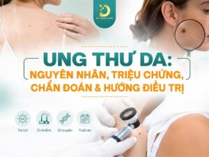 Tìm hiểu về ung thư da