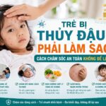 Tìm hiểu về bệnh thủy đậu ở trẻ em