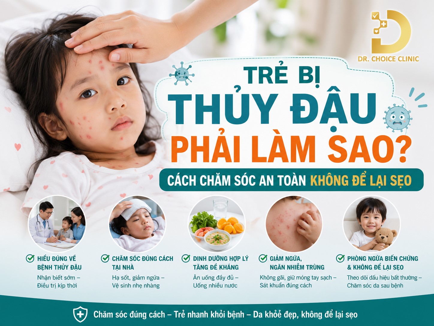 Trẻ Bị Thủy Đậu Phải Làm Sao? Cách Chăm Sóc An Toàn Không Để Lại Sẹo 8 Tìm hiểu về bệnh thủy đậu ở trẻ em