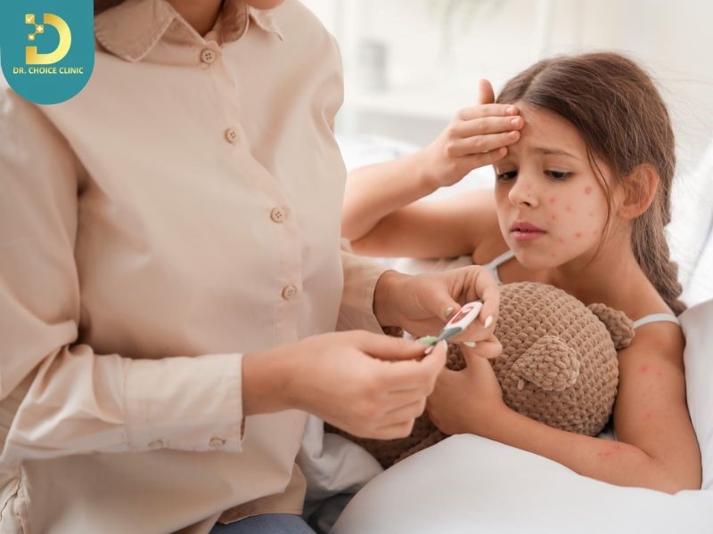 Trẻ Bị Thủy Đậu Phải Làm Sao? Cách Chăm Sóc An Toàn Không Để Lại Sẹo 9 Trẻ bị thủy đậu (ảnh minh họa)