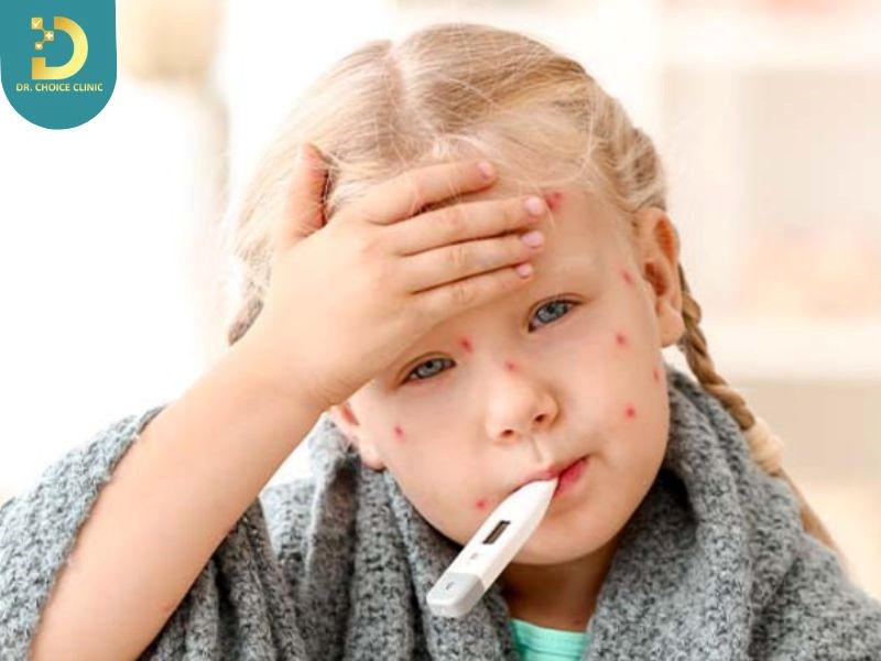 Trẻ Bị Thủy Đậu Phải Làm Sao? Cách Chăm Sóc An Toàn Không Để Lại Sẹo 13 Trẻ bị thủy đậu cần đến cơ sở y tế nếu có dấu hiệu bội nhiễm