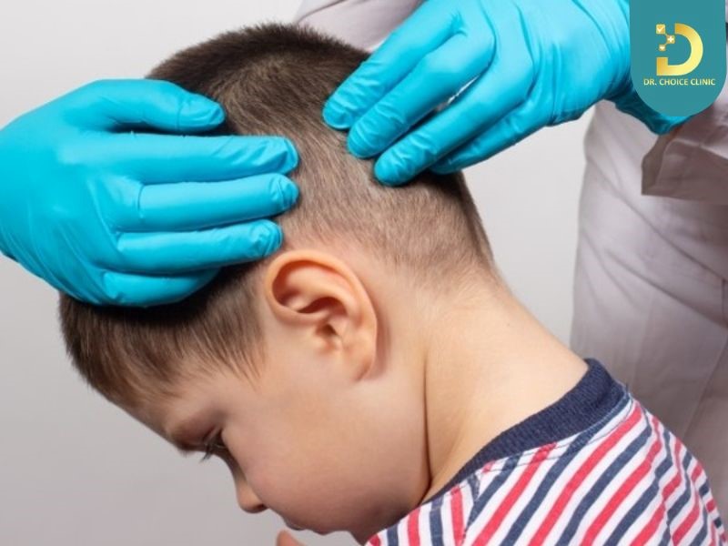 Mụn Nhọt Ở Trẻ Em: Nguyên Nhân, Triệu Chứng Và Cách Xử Lý An Toàn 10 Cha mẹ cần đưa trẻ đến cơ sở y tế khi nhọt lớn nhanh, rất đau, lan rộng hoặc mọc thành cụm
