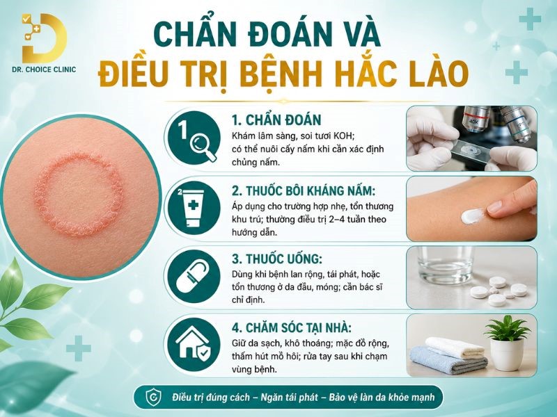 Hắc Lào: Nguyên Nhân, Dấu Hiệu & Cách Điều Trị, Phòng Ngừa 12 Chẩn đoán và điều trị bệnh hắc lào