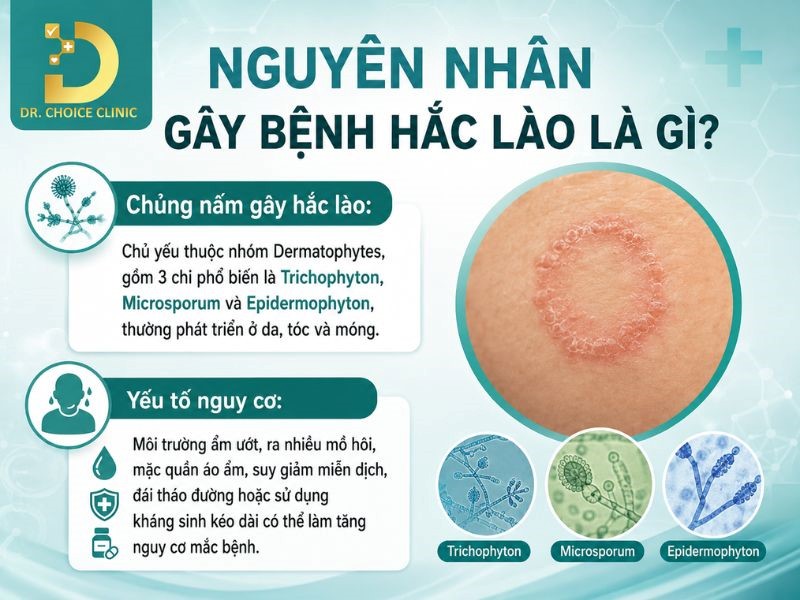 Hắc Lào: Nguyên Nhân, Dấu Hiệu & Cách Điều Trị, Phòng Ngừa 10 Nguyên nhân gây ra bệnh hắc lào